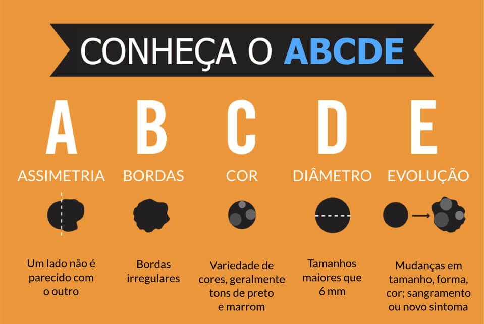 ABCDE-manchas-na-pele Câncer de Pele: O Que é, Tipos, Sintomas e Tratamento